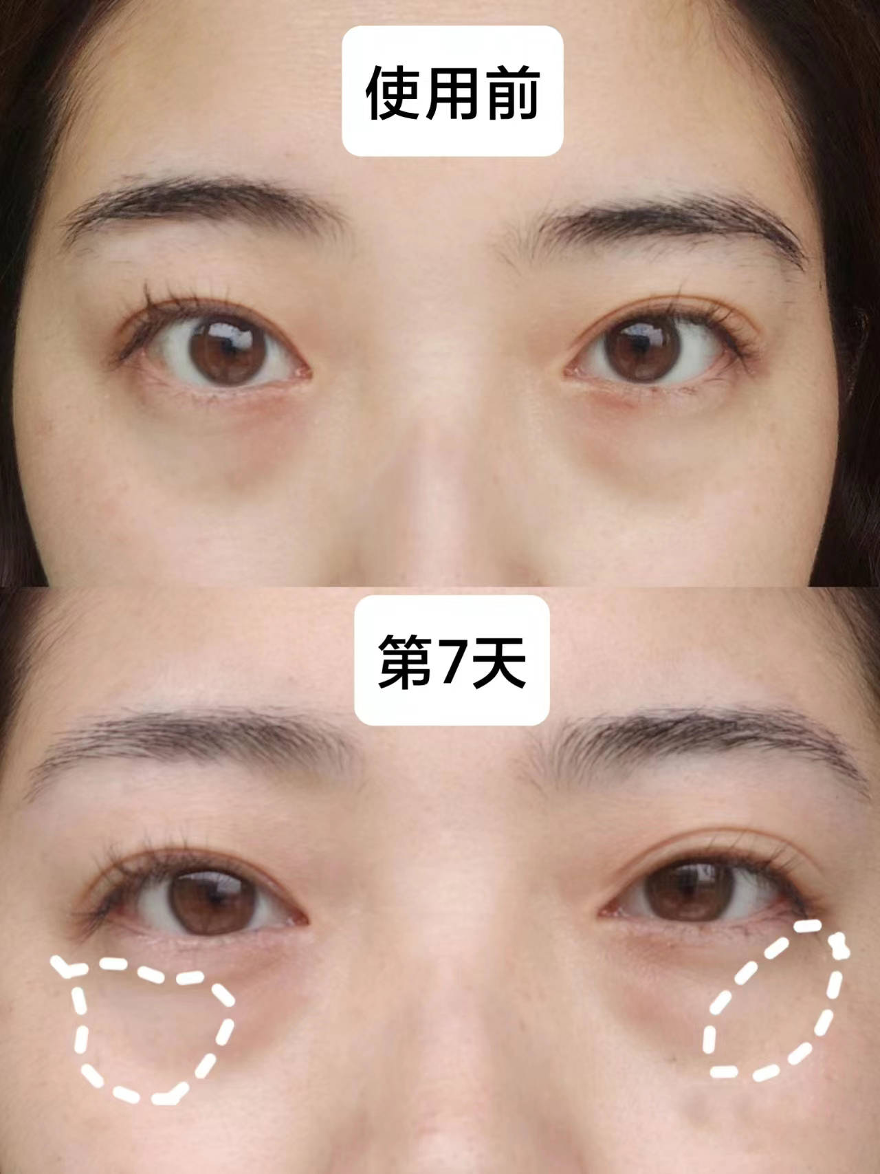 眼霜哪个牌子比较好？抗老眼霜哪个品牌比较好？防止断崖式衰老